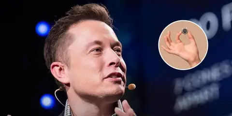 Elon Musk’s Neuralink Unveils Human-Mouse Connection Through Brain Implant