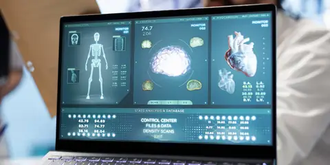 AI Can Now Predict Future Health Risks Like Weather Forecasts