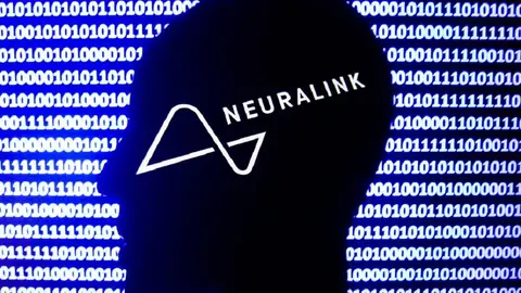 Elon Musk Progresses With Neuralink’s 6-Month Trials