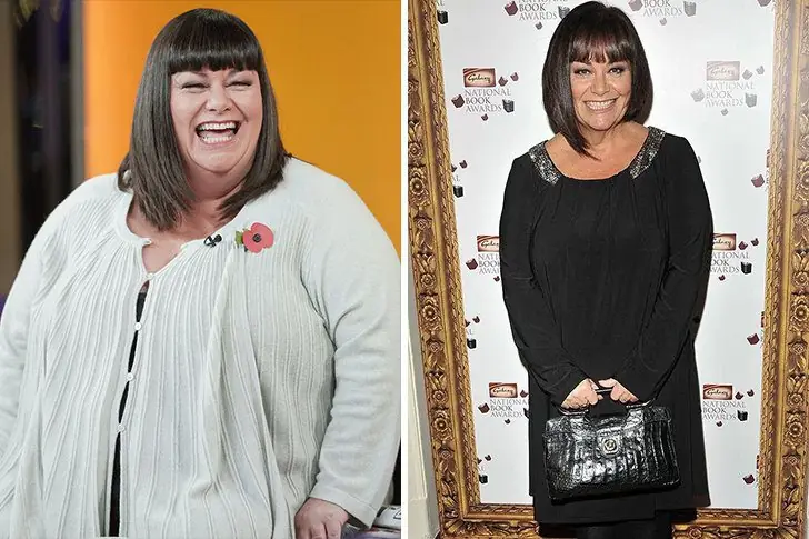 Dawn French – 44 kg