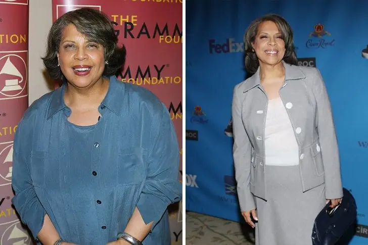 Patti Austin – Cirugía de bypass gástrico / 80 kg